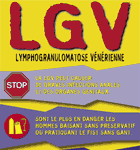 lgv00