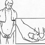 surveiller ses testicules