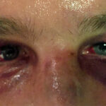 homophobie-violente-rouen