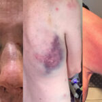 homophobie-violente-rouen-romain