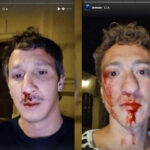 antoine-mickael-instagram