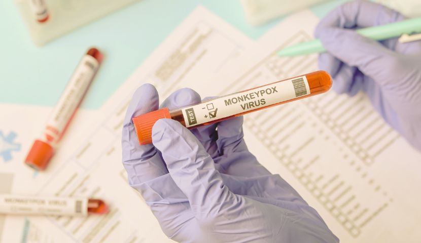 Test PCR Variole du singe Monkeypox